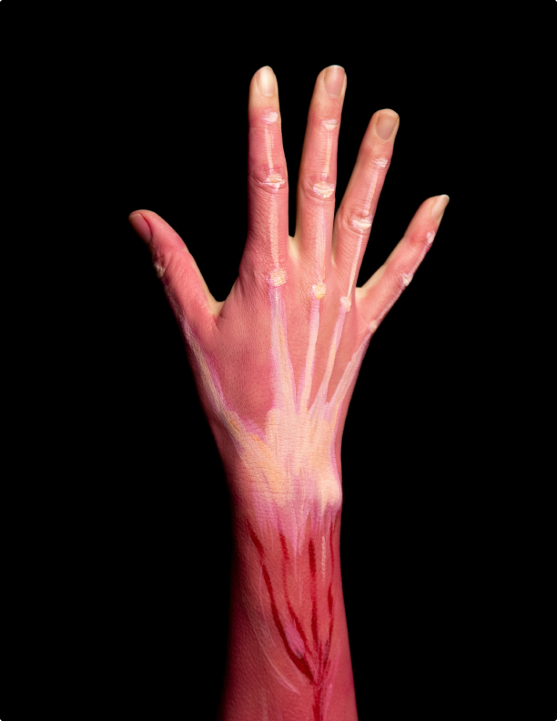 Leeds Limb Centre Hand Detailed Graphic