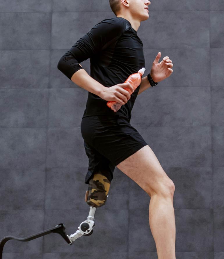 Leeds Limb Centre man running with prosthetic leg holding water bottle