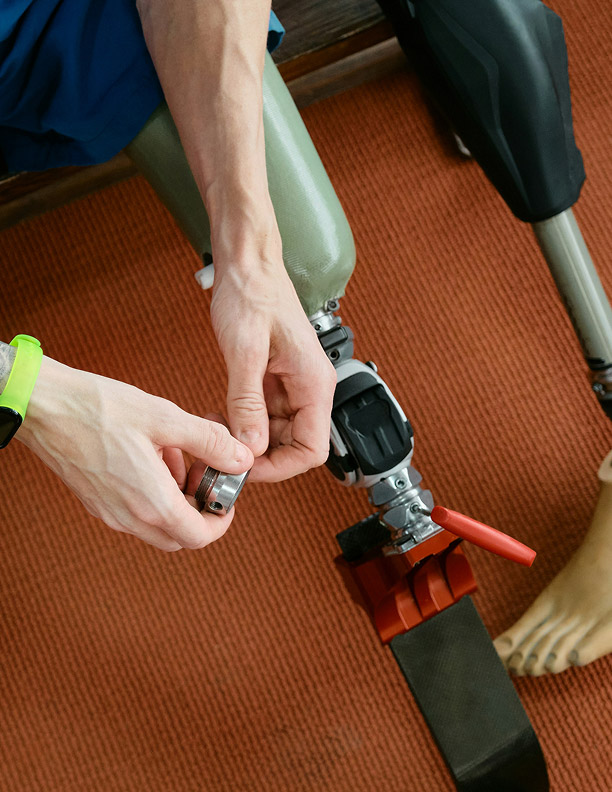 Leeds Limb Centre Prosthetic Leg and Parts