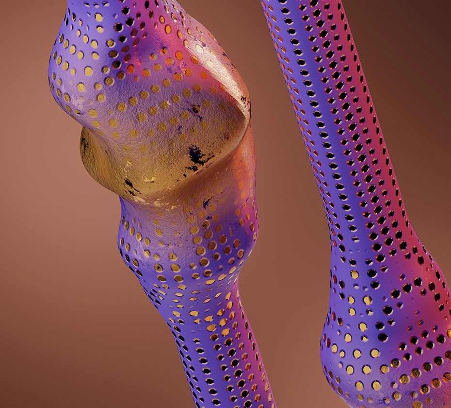 LeedsLimbCentre-Specialisms-LimbReconstruction