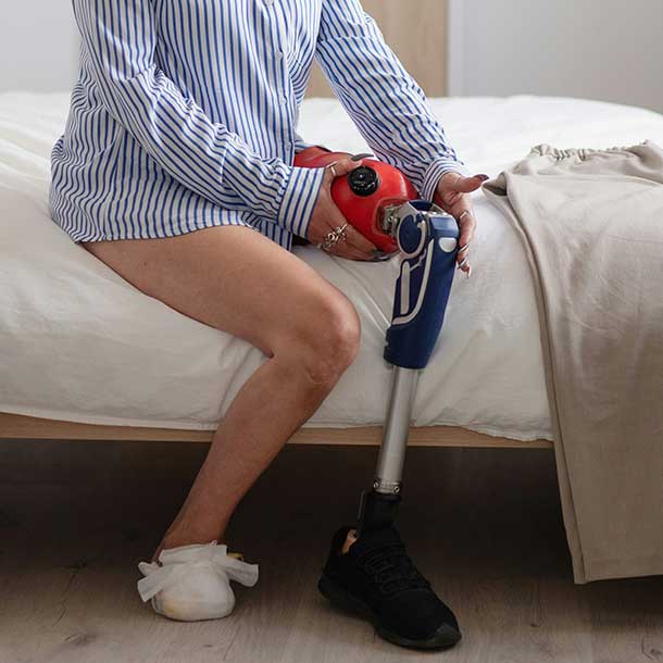 LeedsLimbCentre-Treatment-Amputations-AmputeeCare-RevisionAmputation